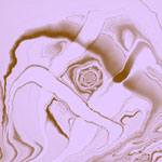   Distortion